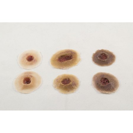 MOULAGE SCIENCE & TRAINING Gunshot Entry Wound, Assorted, PK 6 MST-01-00-06